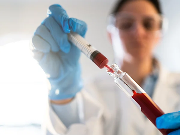 medical technologist emptying a syringe into a vial